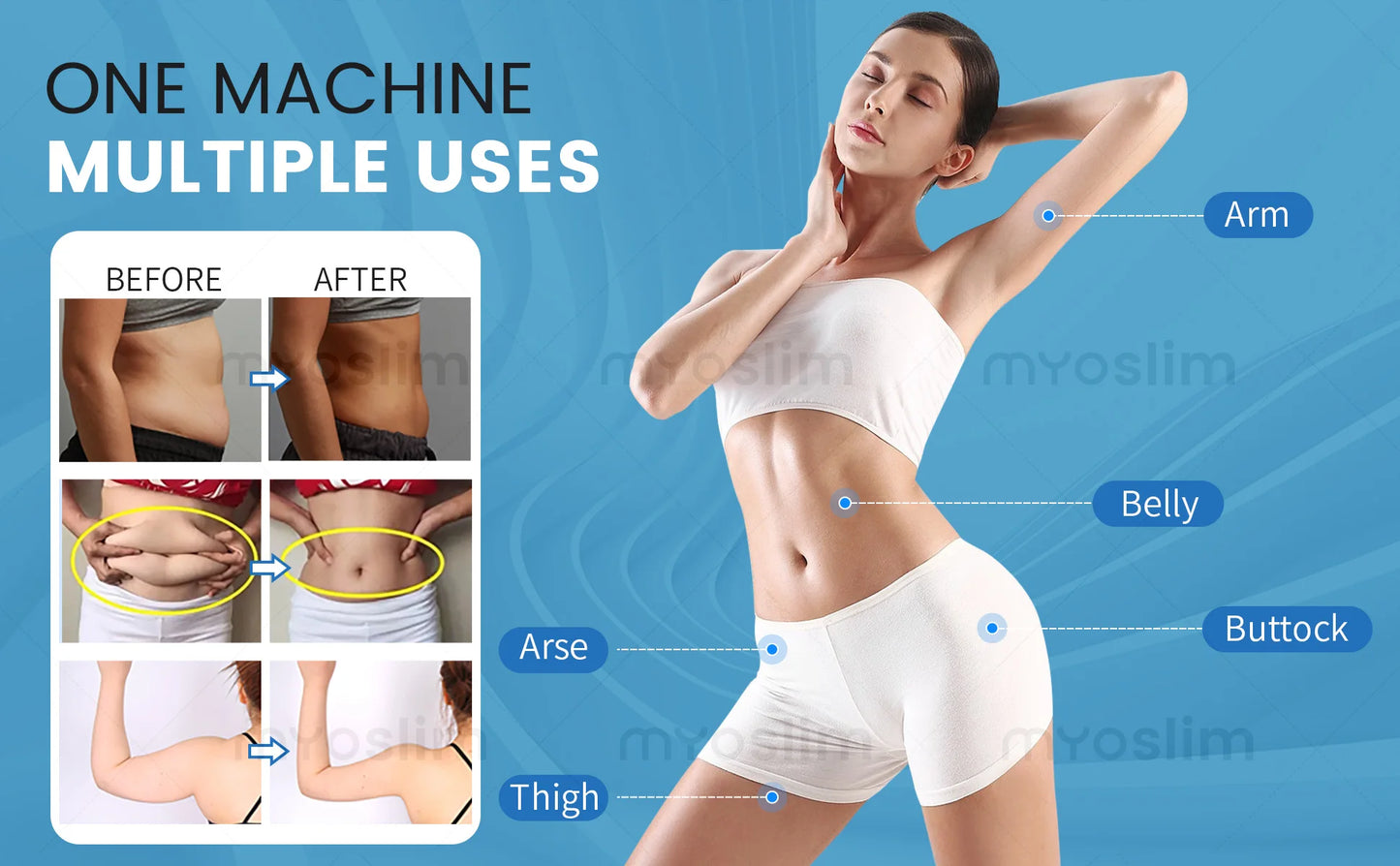 EMS Body Sculpting Machine MYOslim Muscle Building Fat Burning Abdominal Sculpting 15T 6500W Weight Lose Machine