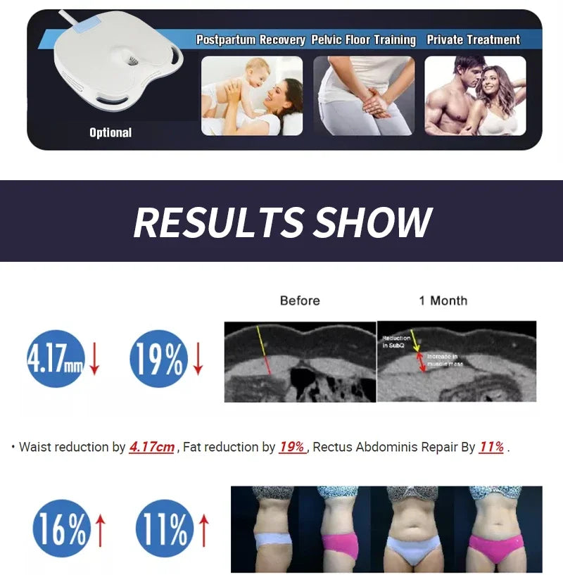 EMSzero HIEMT RF High Intensity Vibration Pulse Electronic Body Shaping Massage Muscle Massage